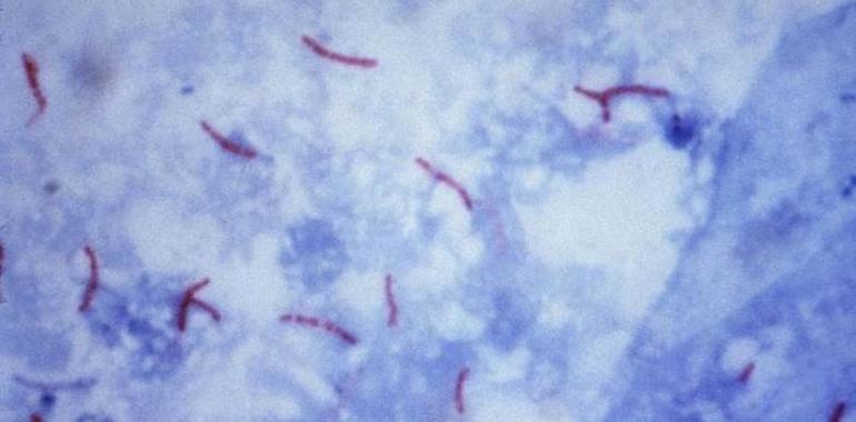 La epidemia de tuberculosis en China deriva de una expansión bacteriana hace mil años