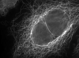 Revelan las señales que controlan la actividad de los microtúbulos, clave en terapias contra el cáncer
