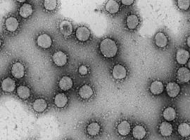 El CSIC impulsa un proyecto para predecir la evolución del nuevo coronavirus