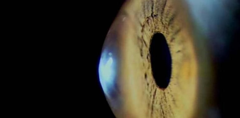 CSIC desarrolla técnicas de imagen nuevas para tratamientos oculares a la carta