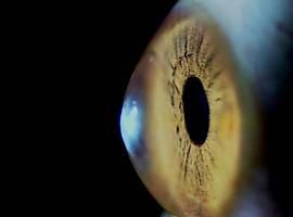 CSIC desarrolla técnicas de imagen nuevas para tratamientos oculares a la carta