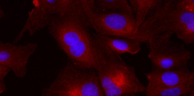 MT1:una proteína clave para frenar el avance de un cáncer de hígado con alta mortalidad