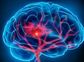 Nuevas perspectivas en la evaluación de daños cerebrales post-accidentes cerebrovasculares