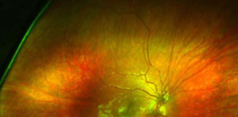 Un dispositivo  permite medir con gran precisión la sensibilidad retiniana