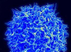 Una red de microtúbulos controla el ataque de los linfocitos T sobre los cuerpos extraños