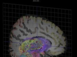 El atlas del cerebro humano, casi terminado