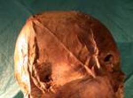 Confirman mediante prueba de ADN que la cabeza momificada de Enrique IV es auténntica