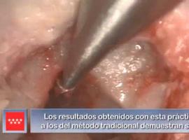 El Severo Ochoa logra exclentes resultados en cirugía de oído mínimamente invasiva