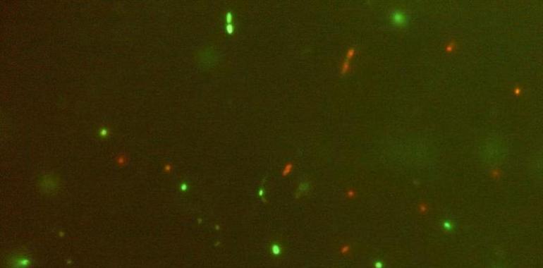 CSIC y UniOvi demuestran que bacterias beneficiosas mejoran el lupus