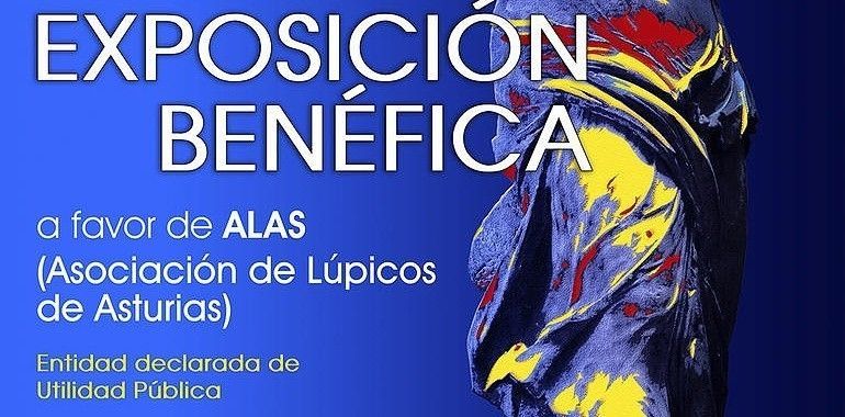 Arte contra el lupus en Oviedo 