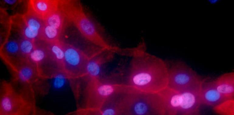 CancerSEEK es capaz de identificar ocho tipos de tumores en fases tempranas