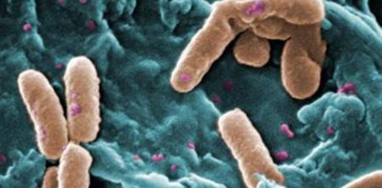 El virus del sida recluta bacterias malignas de la flora intestinal para progresar 