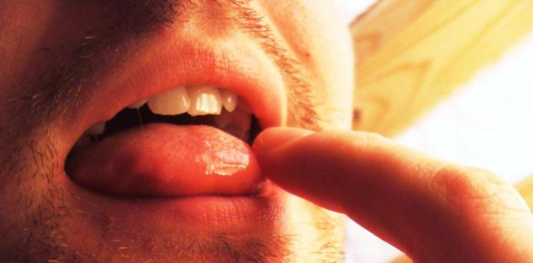 Un biosensor logra identificar cáncer oral en muestras de saliva