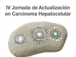 El HUCA reunirá el jueves a 200 especialistas en el manejo del cáncer de hígado