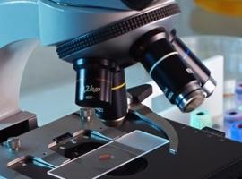 ARAID impulsa el desarrollo de nuevas terapias contra la Tuberculosis