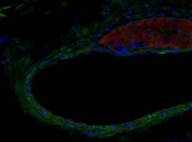 Hallada una nueva molécula eficaz contra la aterosclerosis