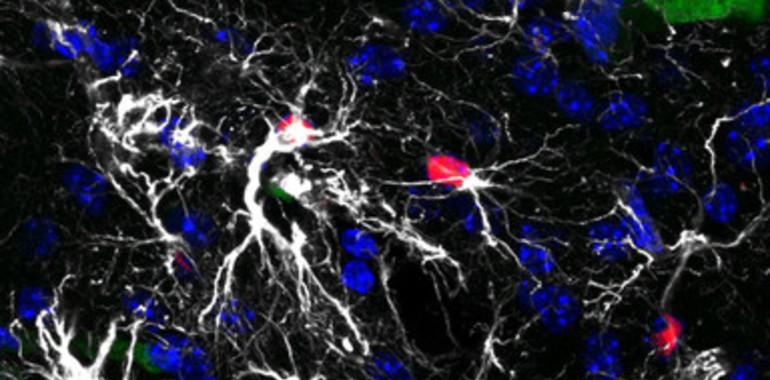 Terapia que alarga la vida de pacientes con metástasis cerebral busca fondos