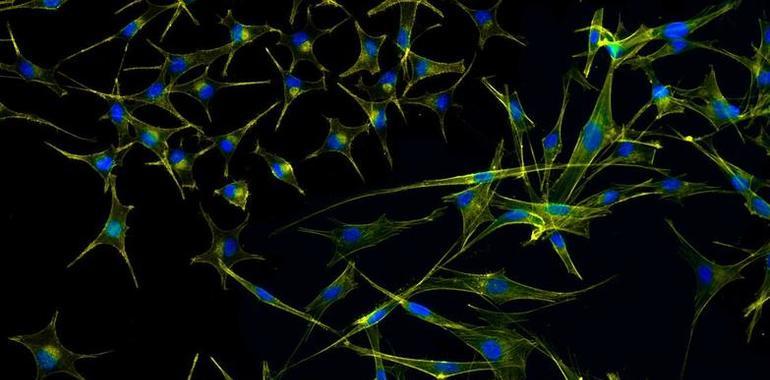 Descubrimiento asturiano mejora la eficiencia de las células mata cánceres