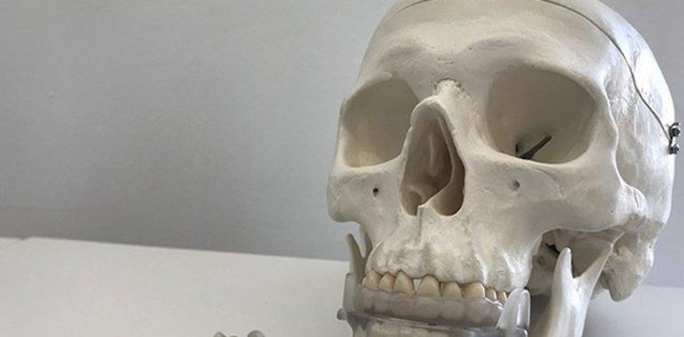 Diseñan un dispositivo bucal que previene la apnea del sueño 