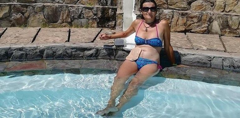 Vivir con una ostomía que te salvó la vida