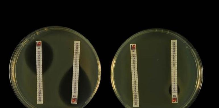 Una nueva técnica predice la resistencia de los microbios intestinales a los antibióticos