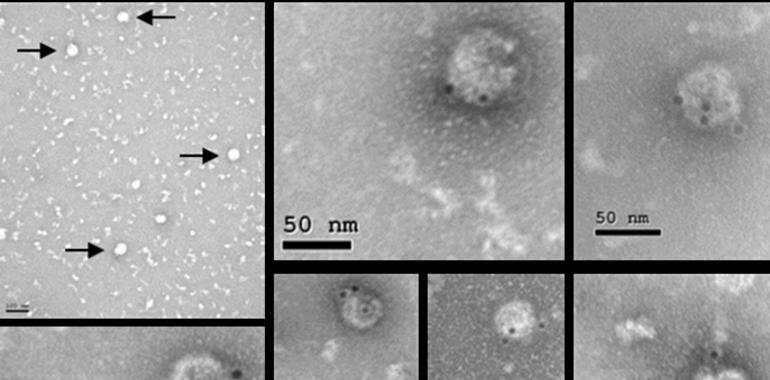 Científicos del CSIC desarrollan una nueva vacuna contra el virus del Zika