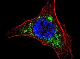 Científicos del CSIC desarrollan nuevas vacunas contra la hepatitis C