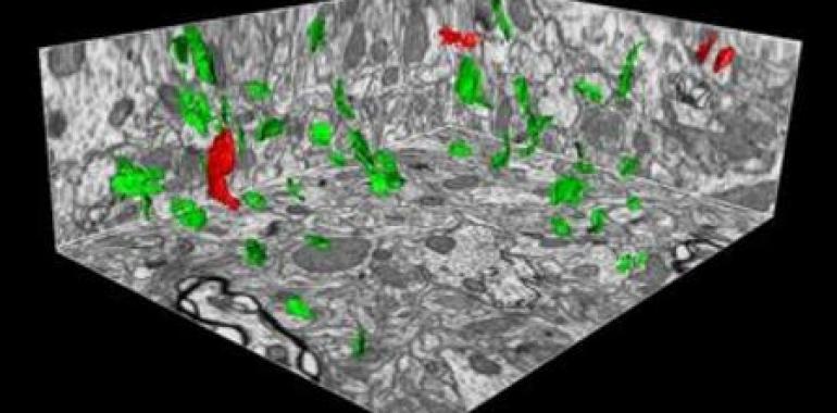 Nueva herramienta informática para el avance de la neurociencia