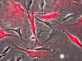 Las células madre cardiacas se refugian en regiones de bajo estrés oxidativo durante el envejecimiento