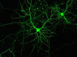 Luz para estudiar y tratar tumores y lesiones cerebrales