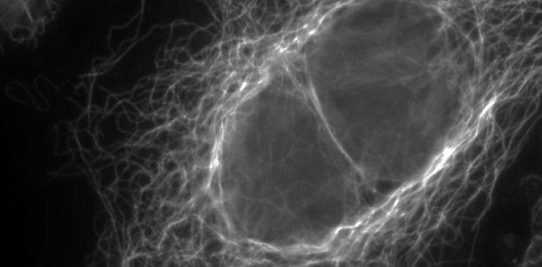 Revelan las señales que controlan la actividad de los microtúbulos, clave en terapias contra el cáncer