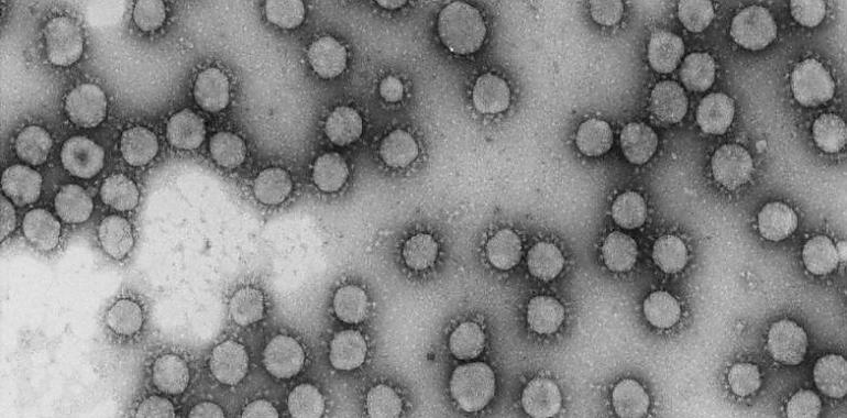 CSIC impulsa investigaciones para atajar el coronavirus 