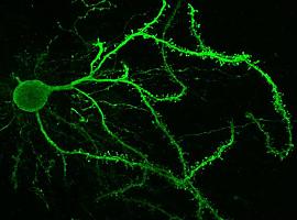 Un receptor de dopamina, clave en el centro cerebral que controla los movimientos