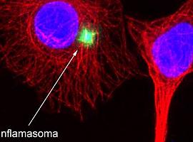 El CSIC avanza en la investigación de fármacos para atenuar los efectos del Coronavirus