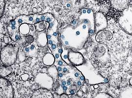  El CSIC obtiene un nanomaterial que elimina el coronavirus y es aplicable en mascarillas y tejidos