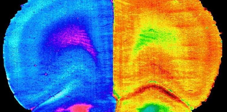 Un equipo liderado por la Universidad de Oviedo halla la forma de revertir un tipo de deterioro cognitivo 