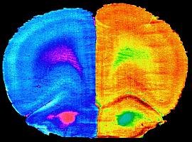 Un equipo liderado por la Universidad de Oviedo halla la forma de revertir un tipo de deterioro cognitivo 