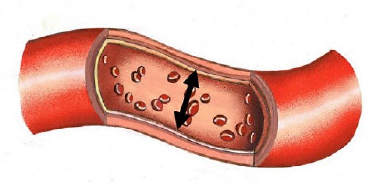 ¿Vigilas suficientemente tu tensión arterial