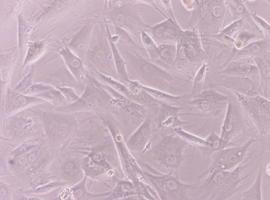 Suspenden el primer ensayo autorizado con células madres embrionarias