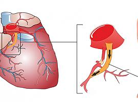 Dicen que los infartos te pillan siempre desprevenido... ¿pero sabes que 8 de cada 10 se pueden prevenir