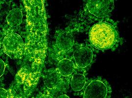Una bacteria comeplástico es el proyecto ganador de Ciencia y Tecnología en Femenino de Avilés