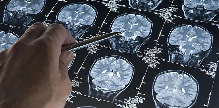 El dia 21 de septiembre se celebra el Día Internacional del Alzheimer con la necesidad imperiosa de seguir investigando