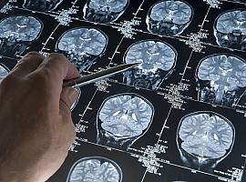 El dia 21 de septiembre se celebra el Día Internacional del Alzheimer con la necesidad imperiosa de seguir investigando