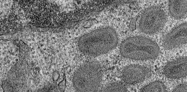 Identifican una proteína clave en la entrada de los poxvirus a las células