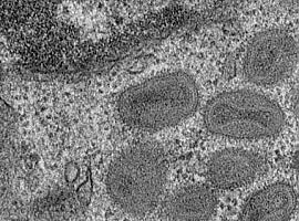 Identifican una proteína clave en la entrada de los poxvirus a las células