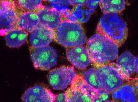 Desarrollo de nanoterapias contra el cáncer mediante nanocápsulas controladas externamente