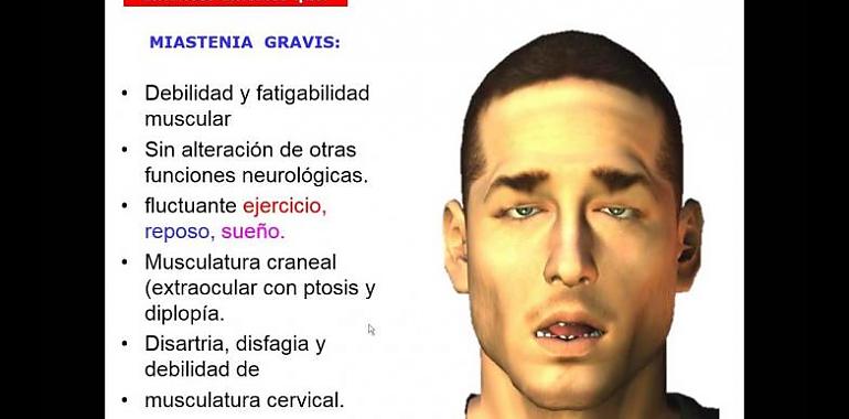 Encuentro sobre Miastenia Gravis y los nuevos tratamientos a la vista en Avilés