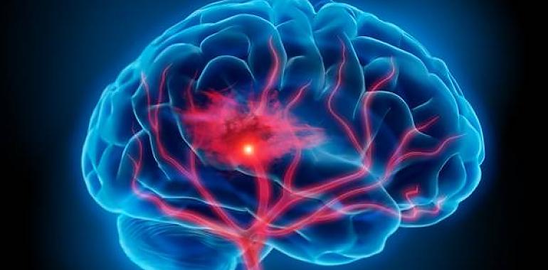 Nuevas perspectivas en la evaluación de daños cerebrales post-accidentes cerebrovasculares