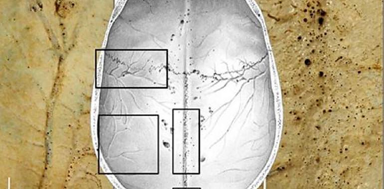 Descubren en el cráneo una red de microcanales que podría ser clave en el Alzheimer, el ictus y la depresión