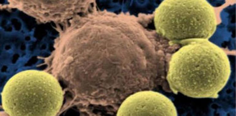 Descubren dos genes clave en la leucemia infantil más común